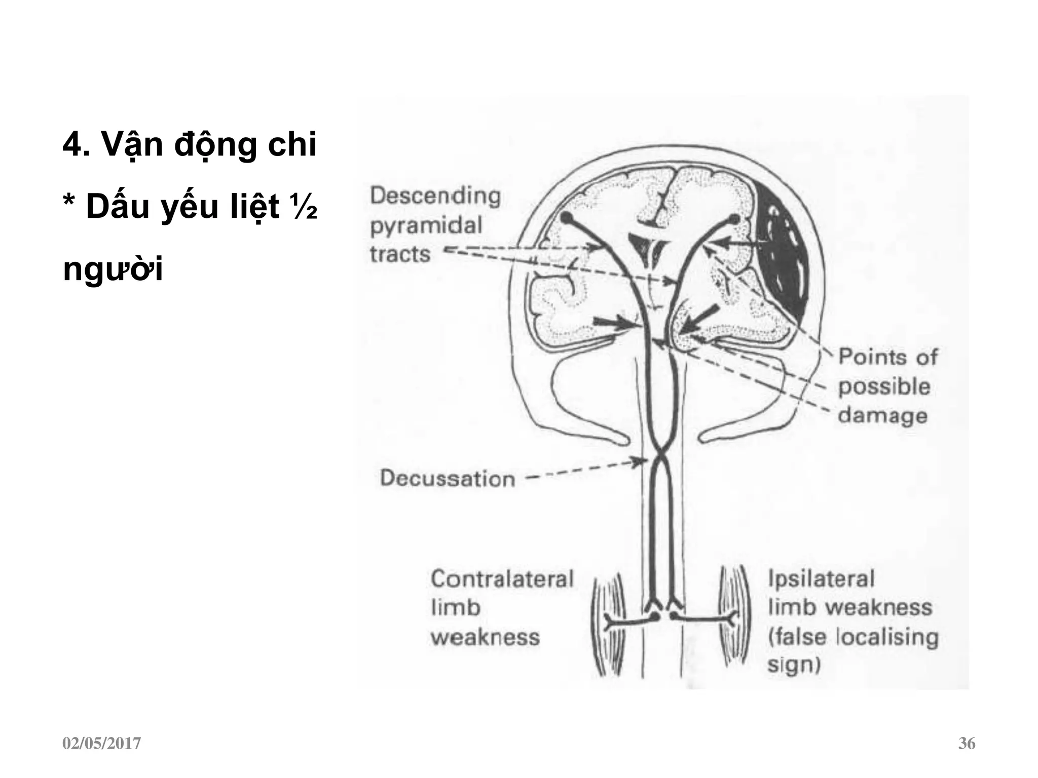 4. Vận động chi
* Dấu yếu liệt ½
ngƣời
02/05/2017 36
 