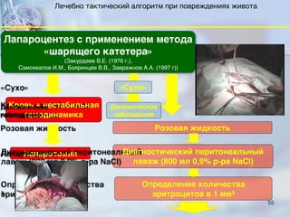 55
Кровь + нестабильная
гемодинамика
Розовая жидкость
Лапаротомия Диагностический перитонеальный
лаваж (800 мл 0,9% р-ра NaCl)
Определение количества
эритроцитов в 1 мм3
Лапароцентез с применением метода
«шарящего катетера»
(Закурдаев В.Е. (1976 г.),
Самохвалов И.М., Бояринцев В.В., Завражнов А.А. (1997 г))
«Сухо»
Динамическое
наблюдение
Лечебно тактический алгоритм при повреждениях живота
 