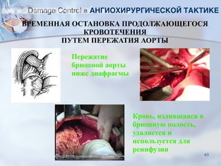 Пережатие
брюшной аорты
ниже диафрагмы
Кровь, излившаяся в
брюшную полость,
удаляется и
используется для
реинфузии
ВРЕМЕННАЯ ОСТАНОВКА ПРОДОЛЖАЮЩЕГОСЯ
КРОВОТЕЧЕНИЯ
ПУТЕМ ПЕРЕЖАТИЯ АОРТЫ
Damage Control в АНГИОХИРУРГИЧЕСКОЙ ТАКТИКЕ
63
 