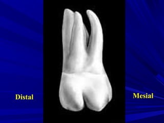 Maxillary second and third molars | PPT