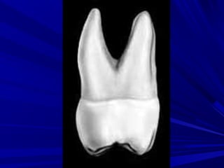 Maxillary second and third molars | PPT