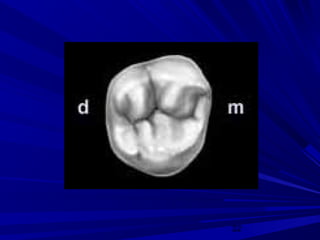 Maxillary second and third molars | PPT