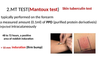 Ppd Amount Injected ZIEHL NEELSEN STAINING presentation.pptx