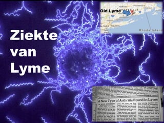 Ziekte van Lyme
Drs. T. Kors
11 april 2013
Ziekte
van
Lyme
1975
Old Lyme
 