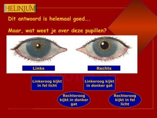 Dit antwoord is helemaal goed…. Maar, wat weet je over deze pupillen? Links Rechts Linkeroog kijkt in fel licht Rechteroog kijkt in donker gat Linkeroog kijkt in donker gat Rechteroog kijkt in fel licht 