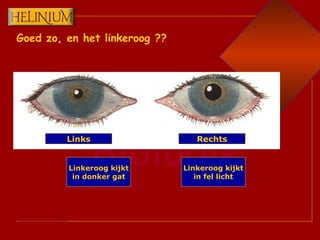 Goed zo, en het linkeroog ?? Links Rechts Linkeroog kijkt in fel licht Linkeroog kijkt in donker gat 