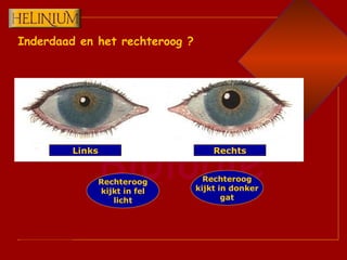 Inderdaad en het rechteroog ? Links Rechts Rechteroog kijkt in donker gat Rechteroog kijkt in fel licht 