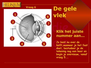 1 2 3 4 6 7 8 5 Klik het juiste nummer aan... Je bent nu over de helft,wanneer je het fout doet, bestudeer je de tekening nog een keer en begin je overnieuw, vanaf vraag 5... De gele vlek Vraag 6 
