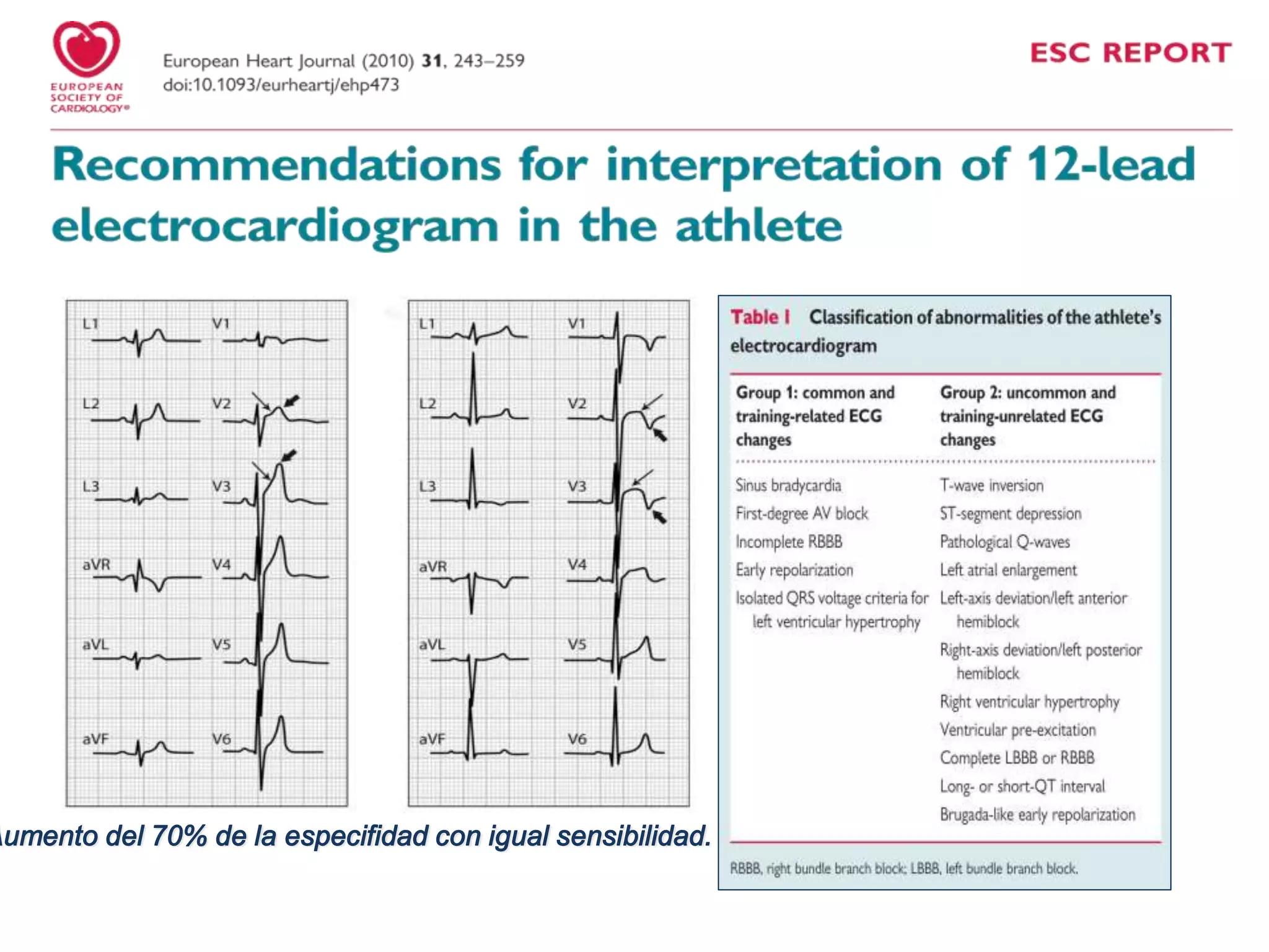 Aumento del 70% de la especifidad con igual sensibilidad.
 