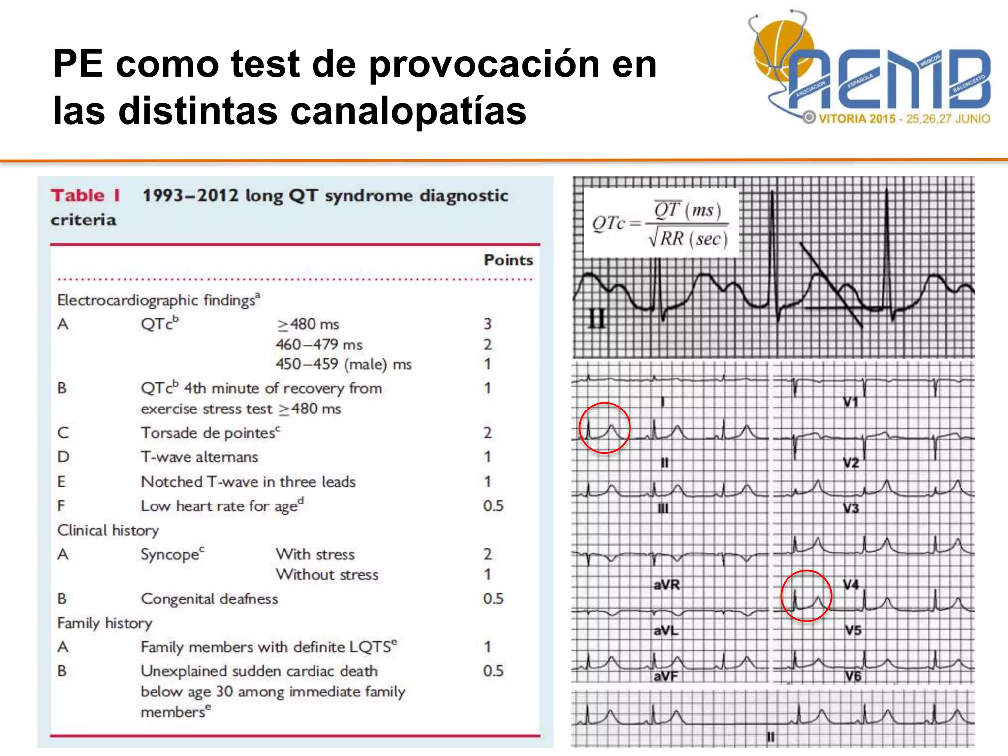 PE como test de provocación en
las distintas canalopatías
 