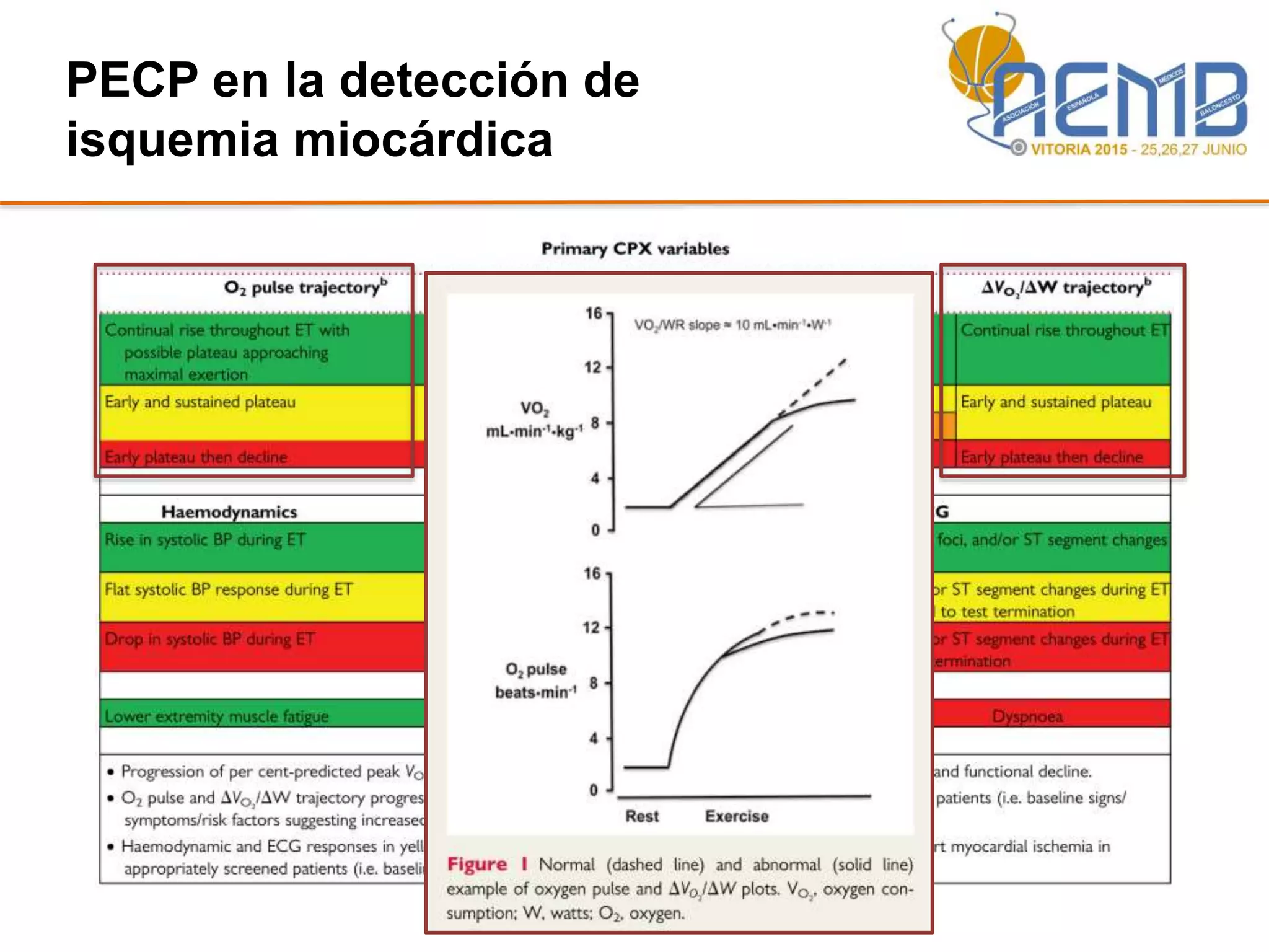 PECP en la detección de
isquemia miocárdica
 