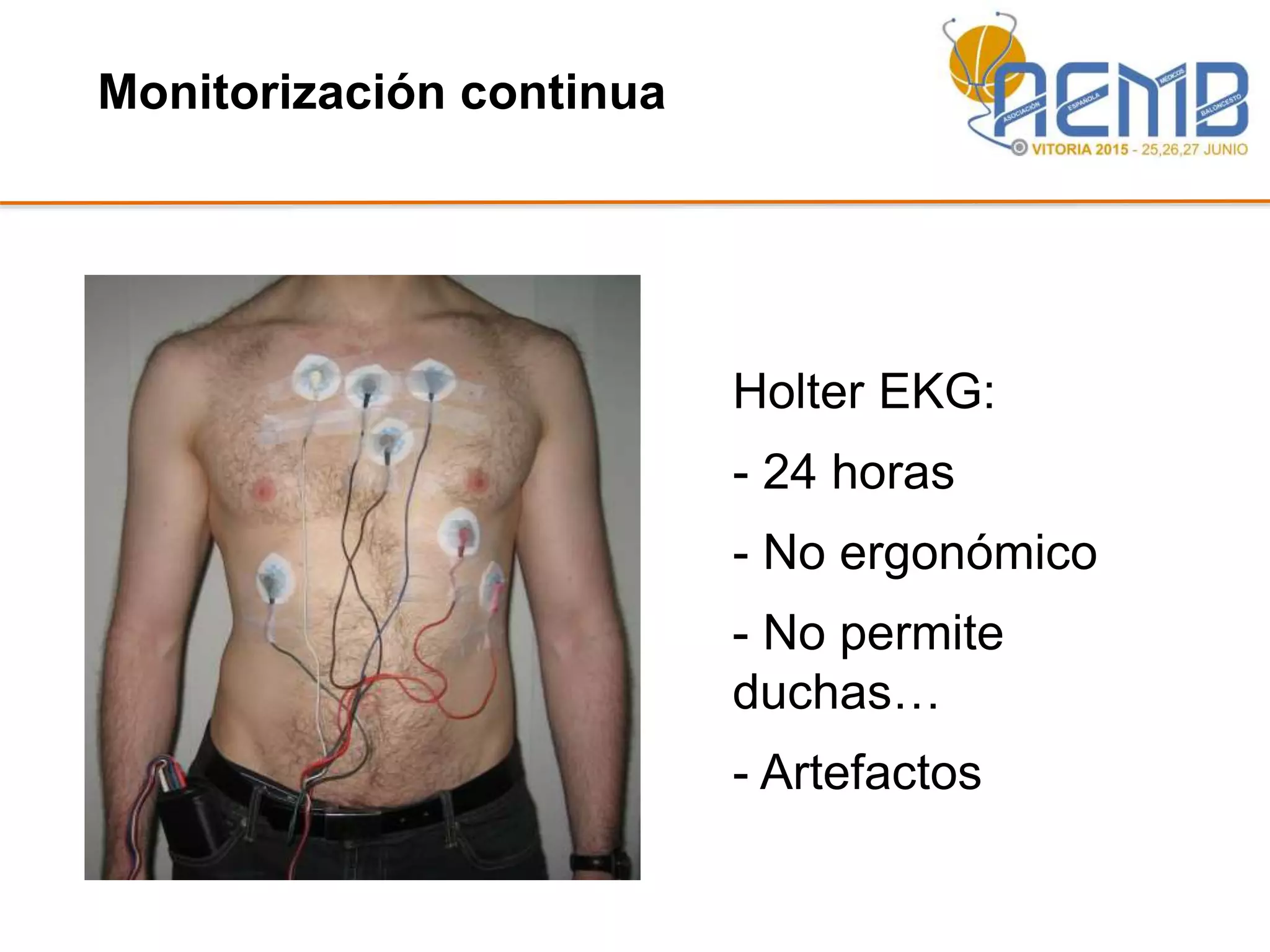 Monitorización continua
Holter EKG:
- 24 horas
- No ergonómico
- No permite
duchas…
- Artefactos
 