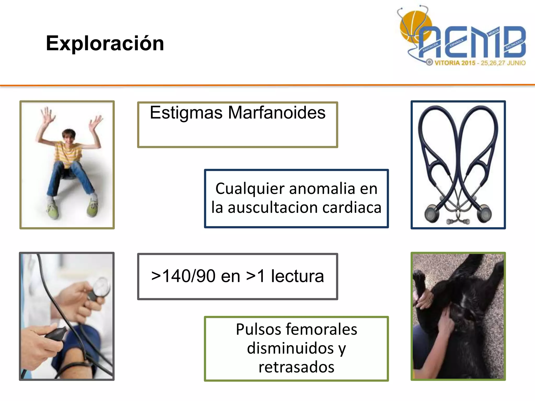 Exploración
Cualquier anomalia en
la auscultacion cardiaca
>140/90 en >1 lectura
Pulsos femorales
disminuidos y
retrasados
Estigmas Marfanoides
 