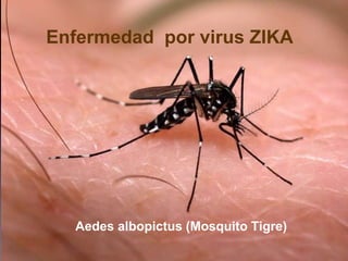 Enfermedad por virus ZIKA
Aedes albopictus (Mosquito Tigre)
 