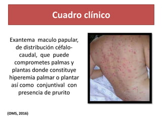 Cuadro clínico
Exantema maculo papular,
de distribución céfalo-
caudal, que puede
comprometes palmas y
plantas donde constituye
hiperemia palmar o plantar
así como conjuntival con
presencia de prurito
(OMS, 2016)
 