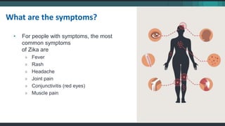 • For people with symptoms, the most
common symptoms
of Zika are
» Fever
» Rash
» Headache
» Joint pain
» Conjunctivitis (red eyes)
» Muscle pain
What are the symptoms?
 