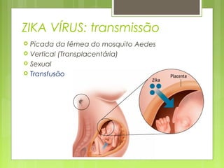 ZIKA VÍRUS: transmissão
 Picada da fêmea do mosquito Aedes
 Vertical (Transplacentária)
 Sexual
 Transfusão
 