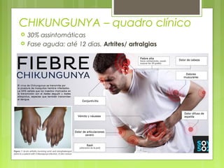 CHIKUNGUNYA – quadro clínico
 30% assintomáticas
 Fase aguda: até 12 dias. Artrites/ artralgias
 