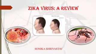 ZIKA VIRUS: A REVIEW
SONIKA SHRIVASTAV
 