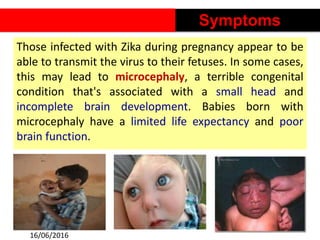 Those infected with Zika during pregnancy appear to be
able to transmit the virus to their fetuses. In some cases,
this may lead to microcephaly, a terrible congenital
condition that's associated with a small head and
incomplete brain development. Babies born with
microcephaly have a limited life expectancy and poor
brain function.
5
Symptoms
16/06/2016
 