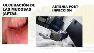 ULCERACIÓN DE
LAS MUCOSAS
(AFTAS)
ASTENIA POST-
INFECCIÓN
 