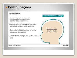  Complicações
 