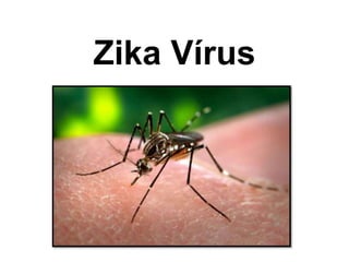 Zika Vírus
 