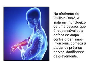 Na síndrome de
Guillain-Barré, o
sistema imunológico
de uma pessoa, que
é responsável pela
defesa do corpo
contra organismos
invasores, começa a
atacar os próprios
nervos, danificando-
os gravemente.
 