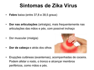 Sintomas de Zika Vírus
• Febre baixa (entre 37,8 e 38,5 graus)
• Dor nas articulações (artralgia), mais frequentemente nas
articulações das mãos e pés, com possível inchaço
• Dor muscular (mialgia)
• Dor de cabeça e atrás dos olhos
• Erupções cutâneas (exantemas), acompanhadas de coceira.
Podem afetar o rosto, o tronco e alcançar membros
periféricos, como mãos e pés.
 