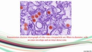 Transmission electron micrograph of zika virus.virusparticle are 40nm in diameter, with
an outer envelope and an inner dense core.
 