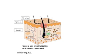 Source: Yang,2022.
FIGURE 1: SKIN STRUCTURES AND
PATHOGENESIS OF BACTERIA
Bacteria
 