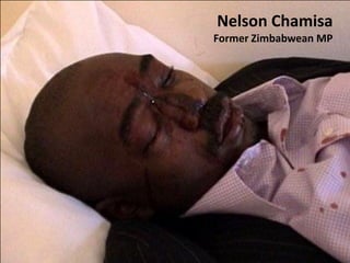 Zimbabwe in Crisis