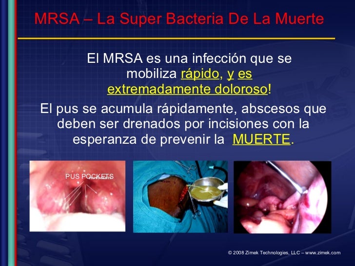 Zimek Power Point Presentation Espanol Febo