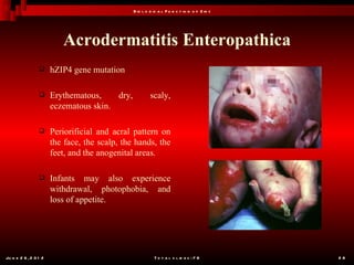 B io l o g ic a l F u n c t io n o f Z in c




                          Acrodermatitis Enteropathica
                      hZIP4 gene mutation

                      Erythematous,    dry,            scaly,
                       eczematous skin.

                      Periorificial and acral pattern on
                       the face, the scalp, the hands, the
                       feet, and the anogenital areas.

                      Infants may also experience
                       withdrawal, photophobia, and
                       loss of appetite.




Ju n e 2 6 , 2 0 1 2                                      T o t a l s l id e s : 7 8         28
 