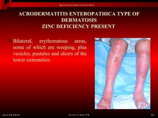 B io l o g ic a l F u n c t io n o f Z in c



                  ACRODERMATITIS ENTEROPATHICA TYPE OF
                              DERMATOSIS
                        ZINC DEFICIENCY PRESENT

           Bilateral, erythematous areas,
            some of which are weeping, plus
            vesicles, pustules and ulcers of the
            lower extremities




Ju n e 2 6 , 2 0 1 2                         T o t a l s l id e s : 7 8         72
 