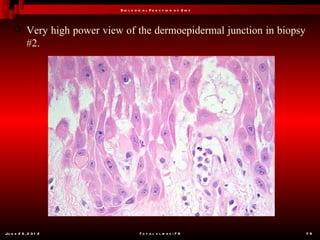 B io l o g ic a l F u n c t io n o f Z in c



           Very high power view of the dermoepidermal junction in biopsy
            #2.




Ju n e 2 6 , 2 0 1 2                       T o t a l s l id e s : 7 8         79
 
