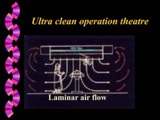 Ultra clean operation theatre
Laminar air flow
 