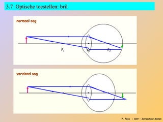 3.7 Optische toestellen: bril

    normaal oog




                         F1     O   F2




    verziend oog




                                         P. Feys - Sint – Jorisschool Menen
 