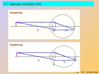 3.7 Optische toestellen: bril

    normaal oog




                         F1     O    F2




    bijziend oog




                          F1
                                    F2
                                O


                                          P. Feys - Sint – Jorisschool Menen
 