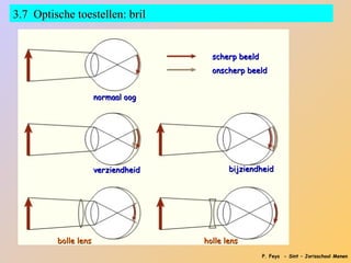 3.7 Optische toestellen: bril


                                       scherp beeld
                                       onscherp beeld


                      normaal oog




                      verziendheid          bijziendheid




         bolle lens                  holle lens
                                                      P. Feys - Sint – Jorisschool Menen
 