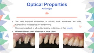 Optical Properties
Advantages
• The most important components of esthetic tooth appearance are: color,
fluorescence, opalescence and translucency.
• One major drawback of full contour zirconia restorations is their opacity.
• Although this can be an advantage in some cases.
 
