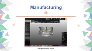 Manufacturing
Virtual restoration design
 