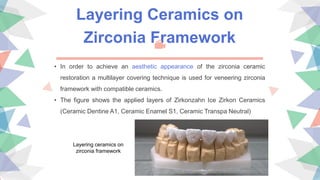 Layering Ceramics on
Zirconia Framework
• In order to achieve an aesthetic appearance of the zirconia ceramic
restoration a multilayer covering technique is used for veneering zirconia
framework with compatible ceramics.
• The figure shows the applied layers of Zirkonzahn Ice Zirkon Ceramics
(Ceramic Dentine A1, Ceramic Enamel S1, Ceramic Transpa Neutral)
Layering ceramics on
zirconia framework
 
