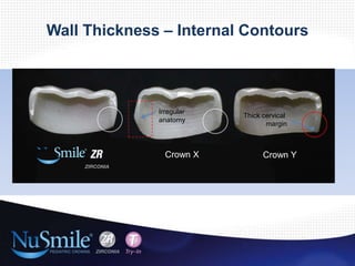 Zirconia crowns for primary anterior and posterior teeth | PPTX