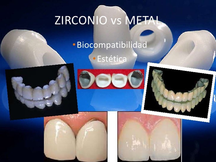 Zirconio dental