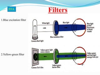 Filters
1.Blue excitation filter
2.Yellow-green filter
FFA
 