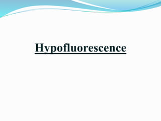 Hypofluorescence
 