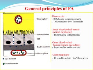 General principles of FA
Fluorescein
• 85% bound to serum proteins
• 15% unbound ‘free’ fluorescein
• Impermeable to fluorescein
Outer blood-retinal
barrier (zonula occludens)
• Impermeable to fluorescein
Choriocapillaris
• Permeable only to ‘free’ fluorescein
Inner blood-retinal barrier
(retinal capillaries)
 