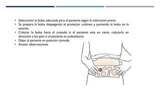 • Seleccionar la bolsa adecuada para el paciente según la valoración previa
• Se prepara la bolsa despegando el protector cutáneo y poniendo la bolsa en la
estoma.
• Colocar la bolsa hacia el costado si el paciente esta en cama, colocarla en
dirección a los pies si el paciente es ambulatorio
• Dejar al paciente en posición cómoda
• Anotar observaciones
 