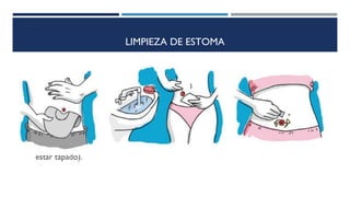 LIMPIEZA DE ESTOMA
• Despegue el adhesivo de arriba hacia abajo, sin tirones, sujetando la piel de
alrededor de la estoma.
• Retire los restos de heces de la estoma con un poco de papel higiénico.
• Limpie la estoma y la piel de alrededor, con agua y jabón neutro, utilizando
una esponjita suave.
• Secar con una toallita de felpa o bien con papel higiénico, sin frotar.
• No se alarme si al pasar con la esponja o al secar, se manchara con un
poquito de sangre (la mucosa está muy vascularizada).
• Puede ducharse o bañarse con o sin bolsa (si deja la bolsa el filtro debe
estar tapado).
 